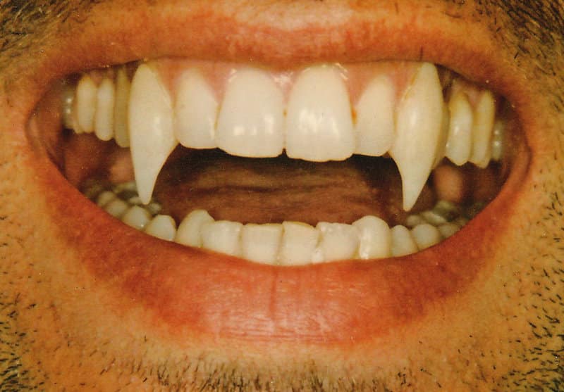 dracula teeth by mantisred1