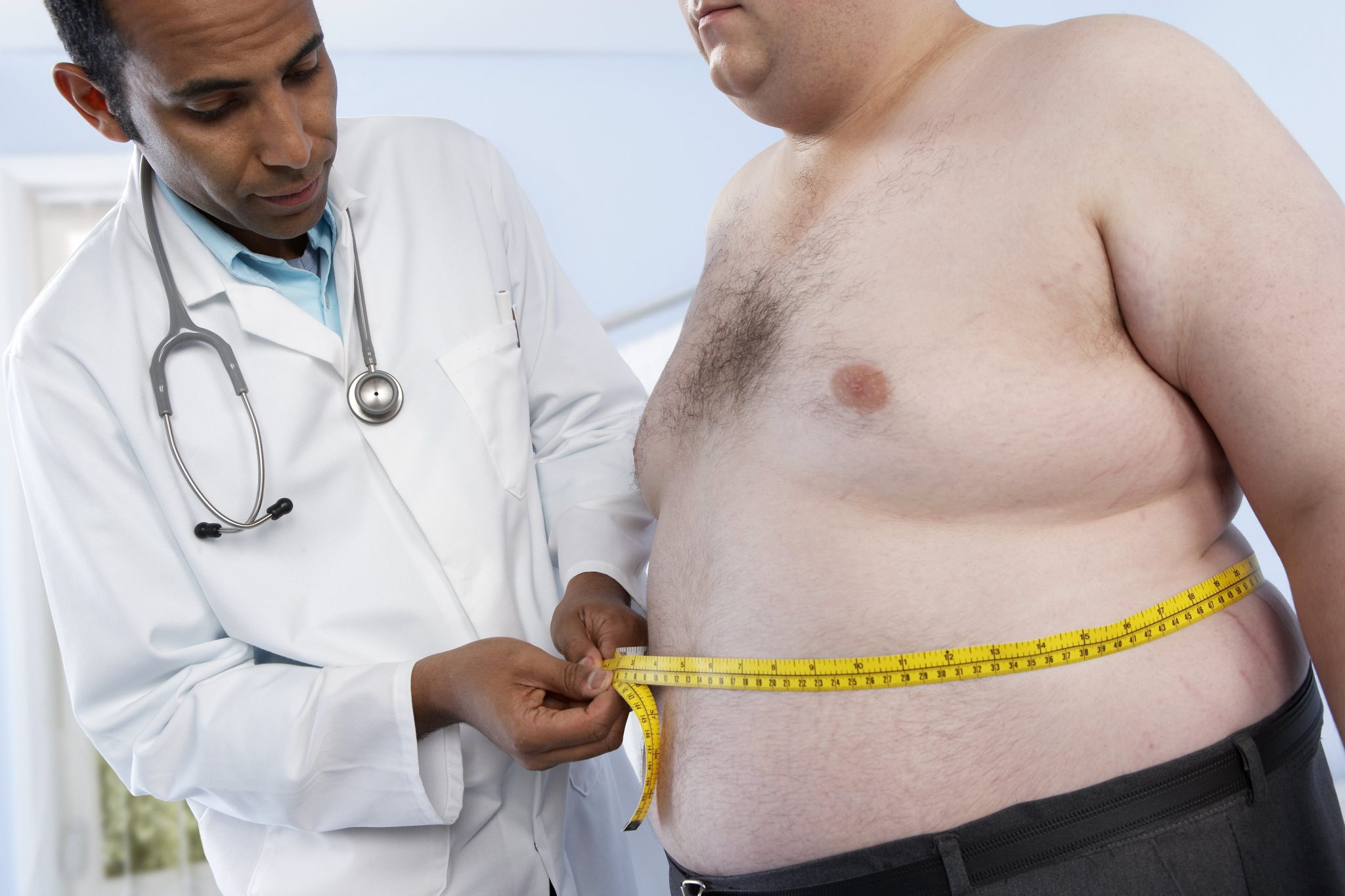 160412 obesity stock 3424566907 scaled