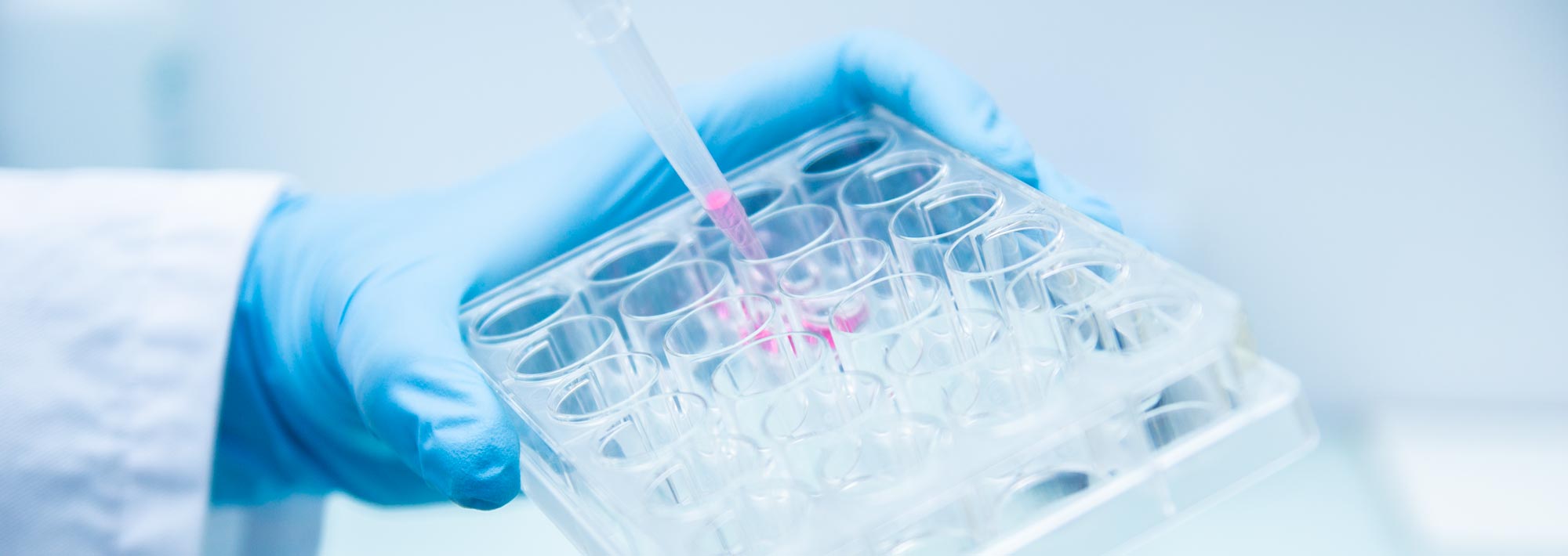 page invitro model human plasma4 27724741