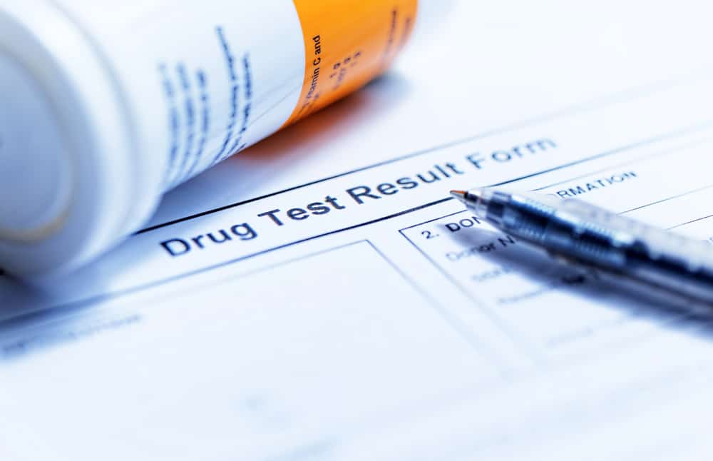 How to Handle Workplace Substance Concerns random drug test results 1822596223