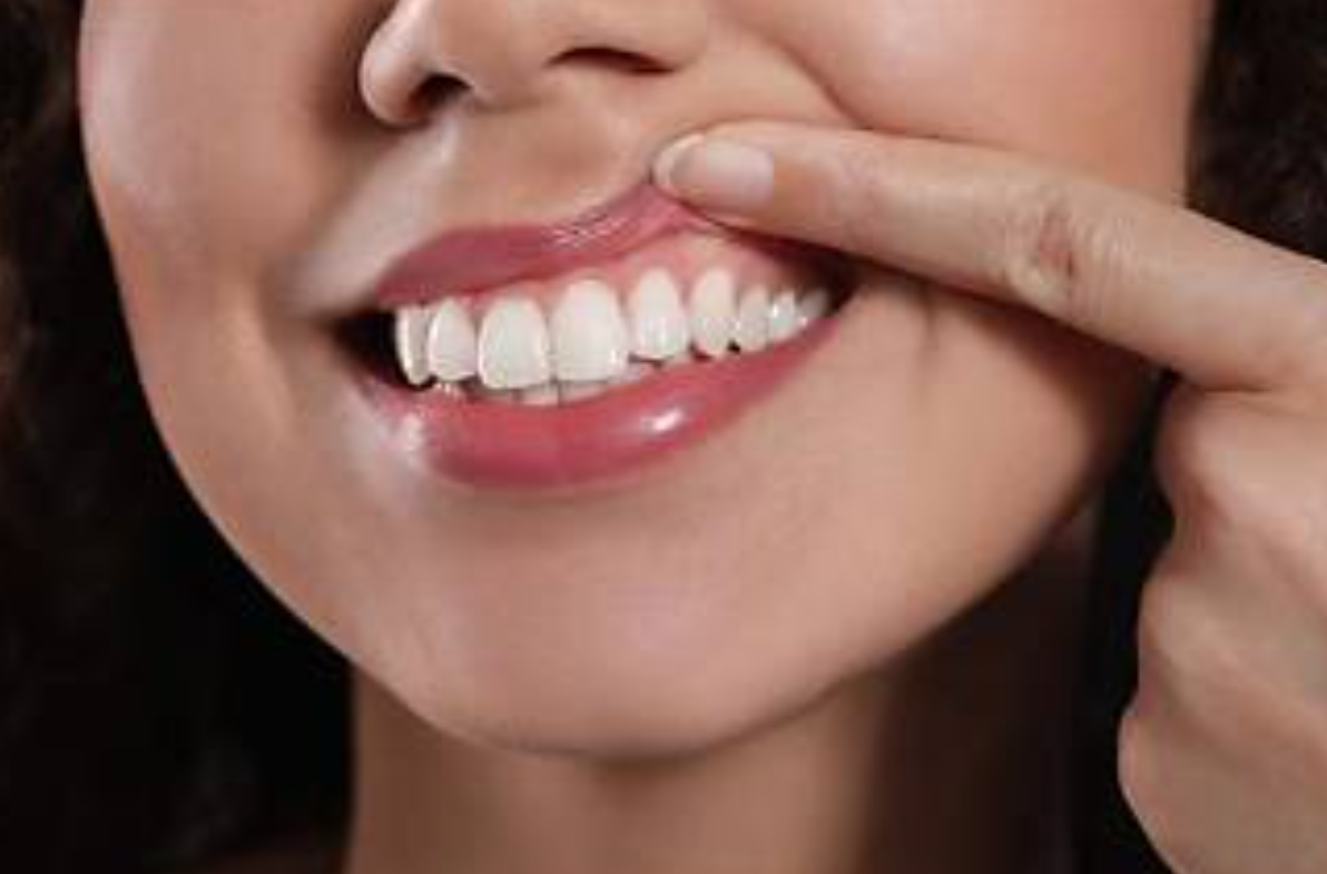Fundamentals of Gum Health With an Expert in White Rock for Adults Over Forty-Five Screenshot 2026 08 25 085350